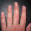 10 Facts about Fingernails